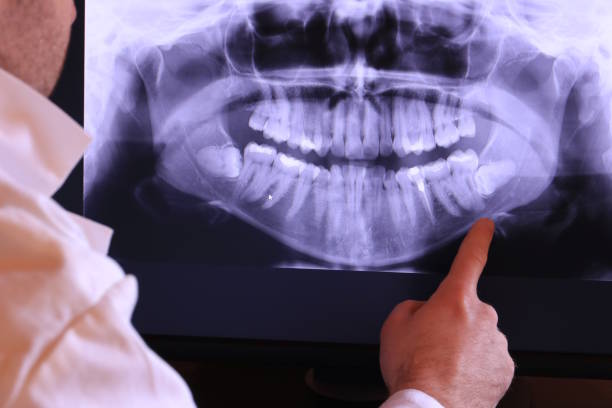 Best Broken or Chipped Tooth Repair in Thedral City, CA